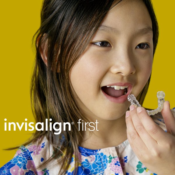 A smiling asian girl is holding an invisalign in her left hand and acting about to put it in her mouth